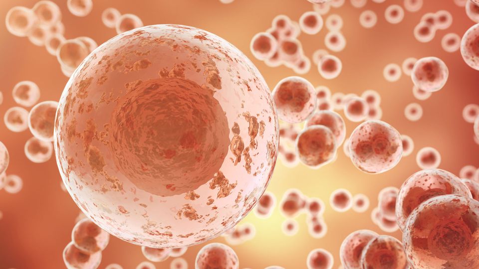 Microscopic image of orange cancer cells.