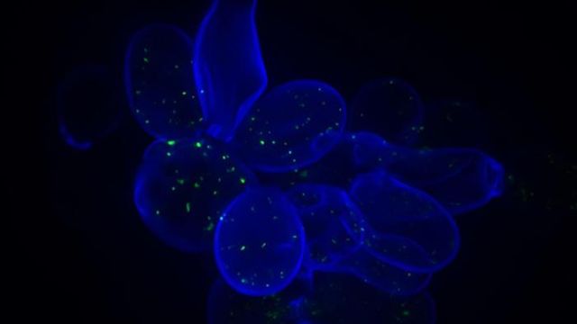 Yeast cells whose cell walls have been stained blue. 