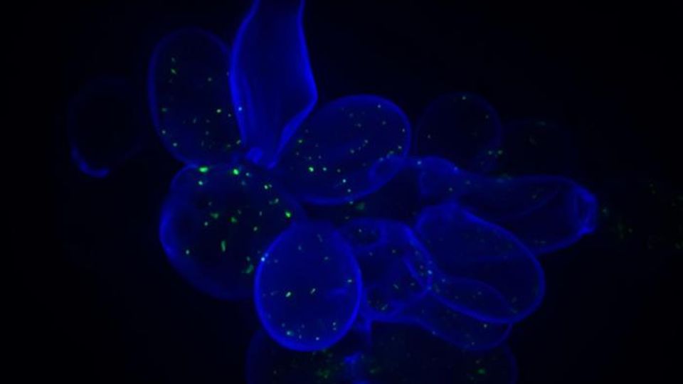 Yeast cells whose cell walls have been stained blue.