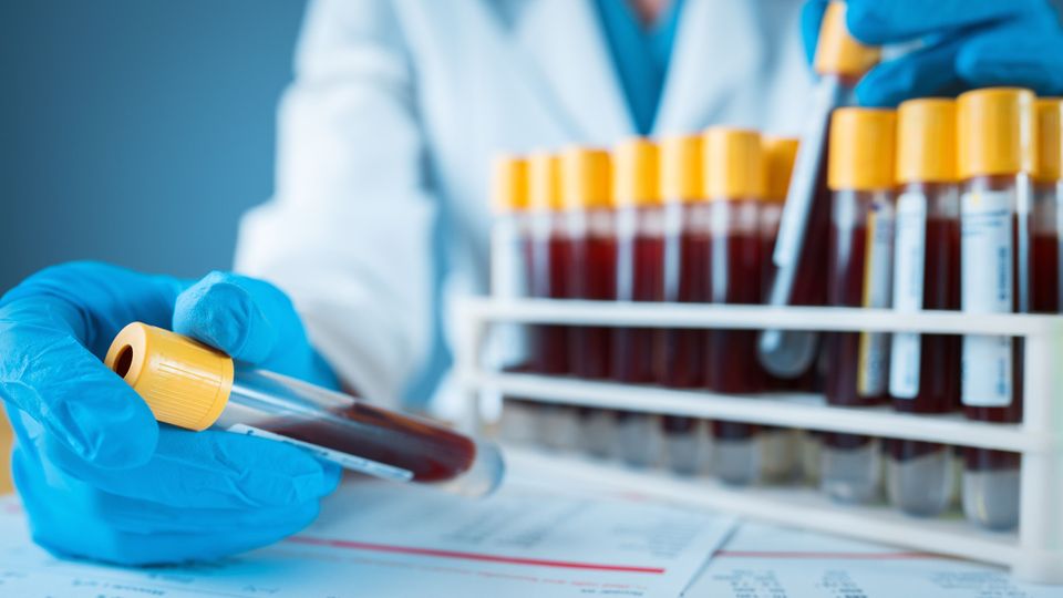Scientist removing a blood sample from a rack of samples in a clinical lab. 