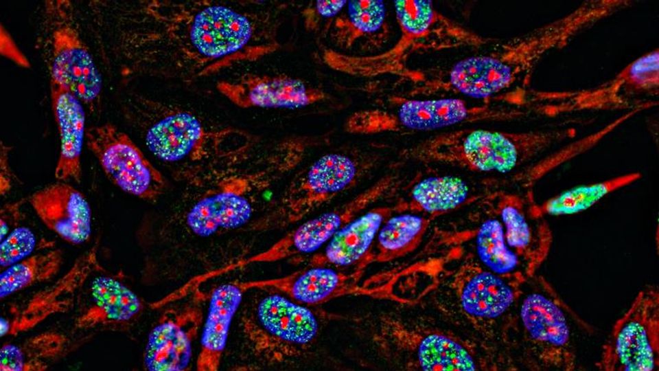 Fluorescent microscopy image showing cellular structures used in spatial transcriptomics research for mapping gene expression.