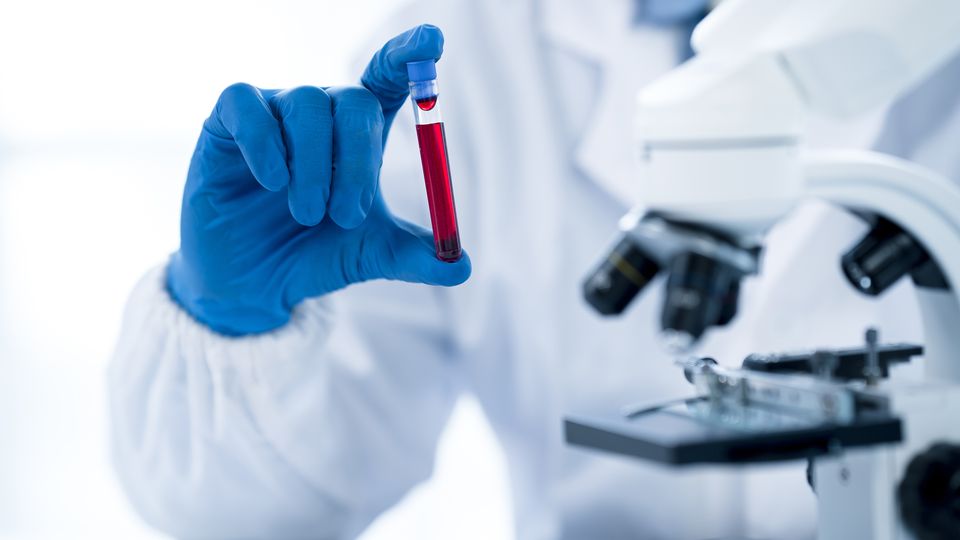 Clinical scientist holding a tube of blood next to a microscope. 