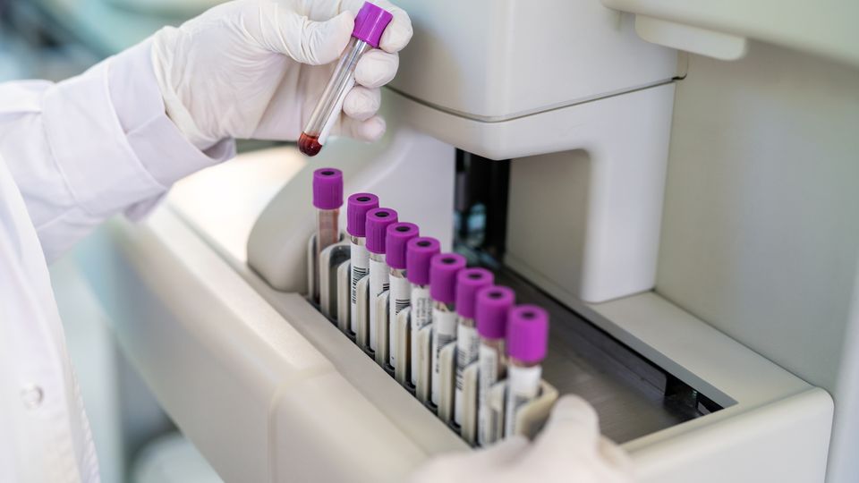 Lab technician placing blood samples into an analyzer for diagnostic blood testing.