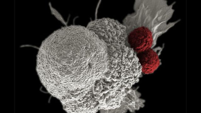 Two red immune cells attack a white cancer cell. 