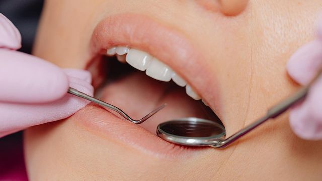 Multiple Sclerosis and the Oral Microbiome Connection