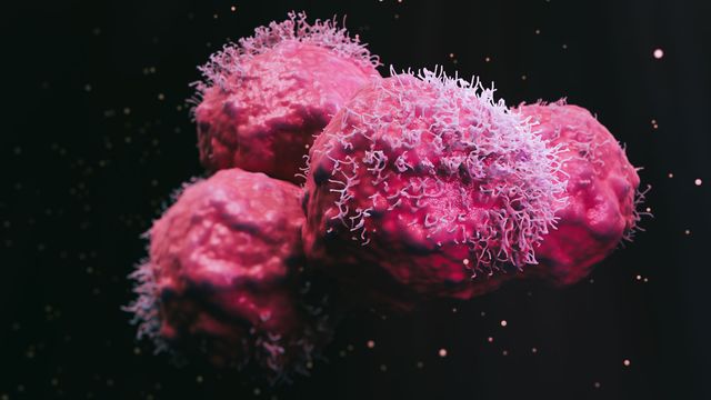 SEM image of malignant cancer cells used in doxorubicin drug tracking research. 