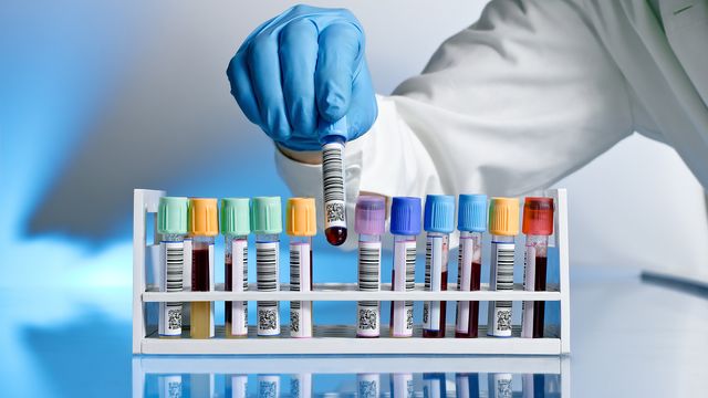 Clinical scientist removing a blood sample from a rack of test tubes containing patient's blood. 