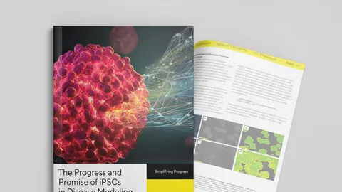 Scientific report on advancing neurodegenerative disease research with iPSCs, featuring a digital cell illustration and open pages showing cellular analysis.