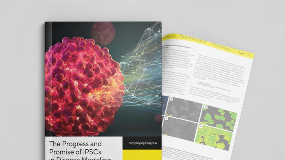 Scientific report on advancing neurodegenerative disease research with iPSCs, featuring a digital cell illustration and open pages showing cellular analysis.