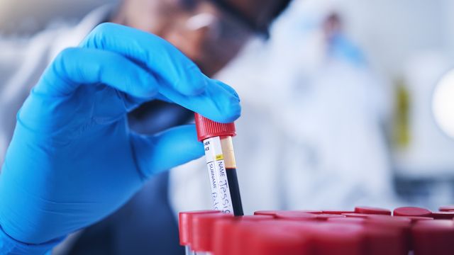 A scientist lifting a blood sample test tube out of a test tube rack. 