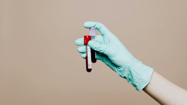 A gloved hand holds two tubes containing blood samples. 