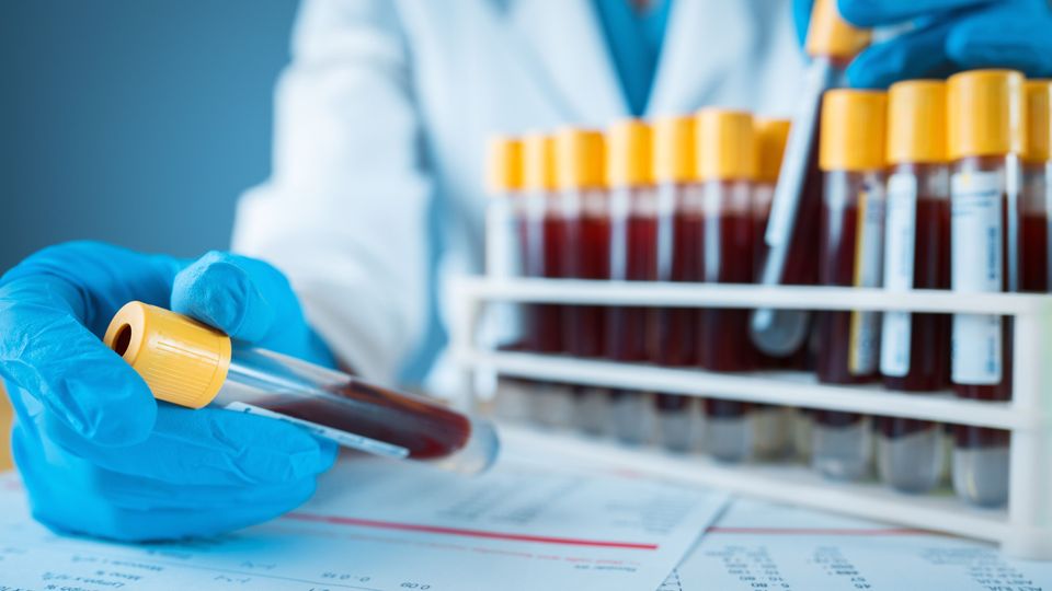 Laboratory technician preparing blood samples for Alzheimer's study.
