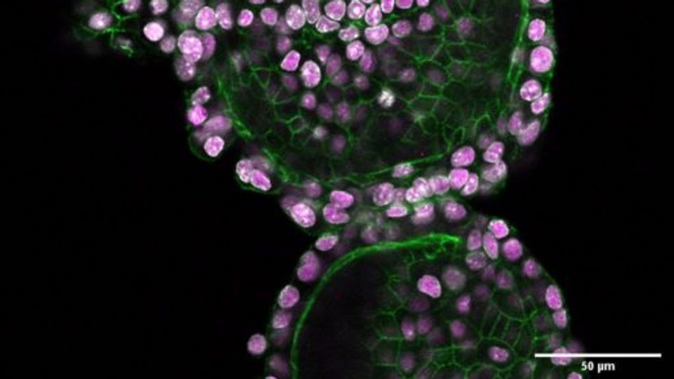 Murine Thyroid Organoids frozen in CELLBANKER® 1 during the lockdown and imaged post-thaw. IF staining for DAPI, Pax8 (marker of thyroid gland organogenesis), and Phalloidin (white/magenta/green). 
