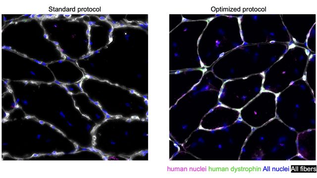 Human muscle cells derived from the Caputo et al. optimized protocol efficiently regenerate muscle tissue upon transplantation in mice. 