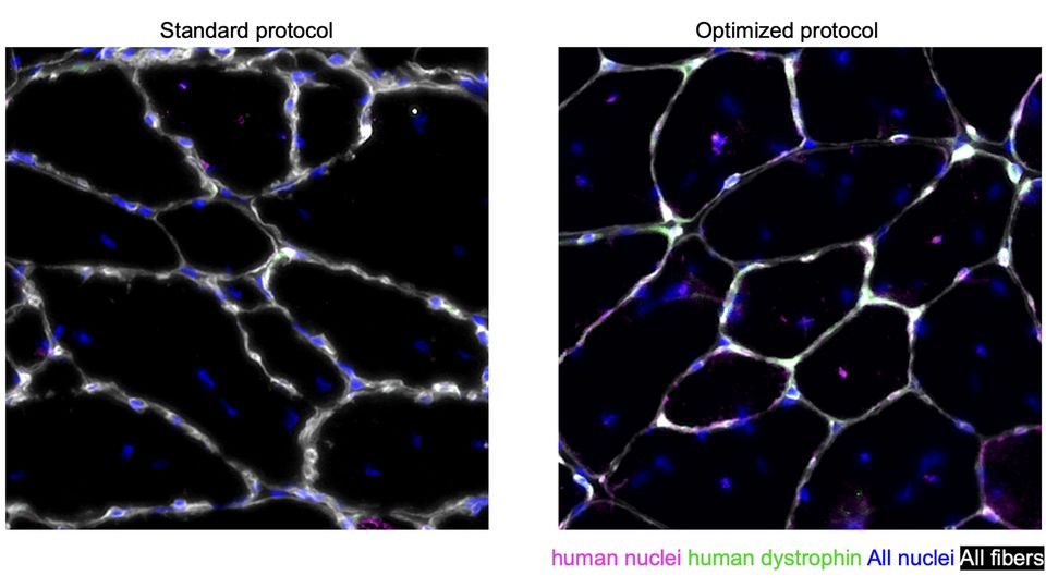 Human muscle cells derived from the Caputo et al. optimized protocol efficiently regenerate muscle tissue upon transplantation in mice.