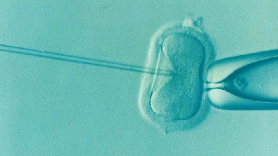Microscopic view of IVF procedure showing a needle injecting sperm into an egg.