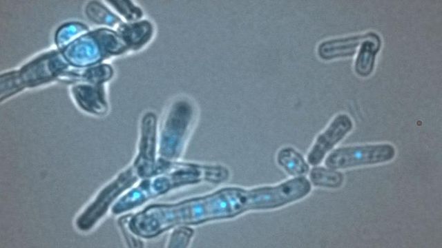 Microscopic view of cells showing fluorescence-tagged dicer proteins involved in RNA interference. 