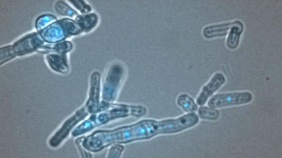 Microscopic view of cells showing fluorescence-tagged dicer proteins involved in RNA interference.