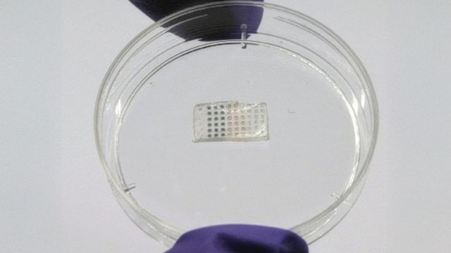 The programmable drug-delivery patch. 
