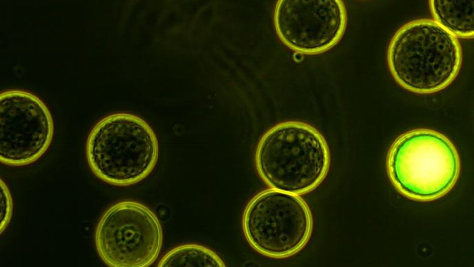 A micrograph shows several individual microcapsules including one, brightly lit one in the lower right corner, that contains amplified DNA from a single particle.
