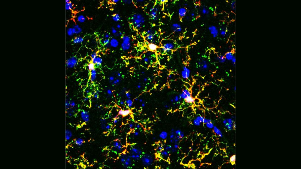 Fluorescence microscopy image of transplanted microglia in a mouse brain.