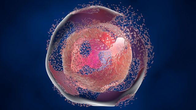 A cancer cell undergoes cell death, spilling its contents into the environment. 