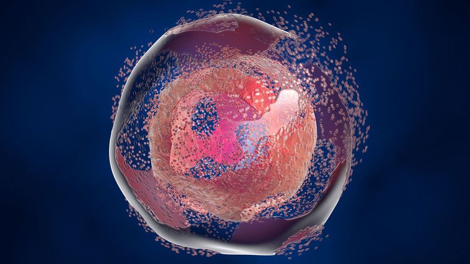 A cancer cell undergoes cell death, spilling its contents into the environment.