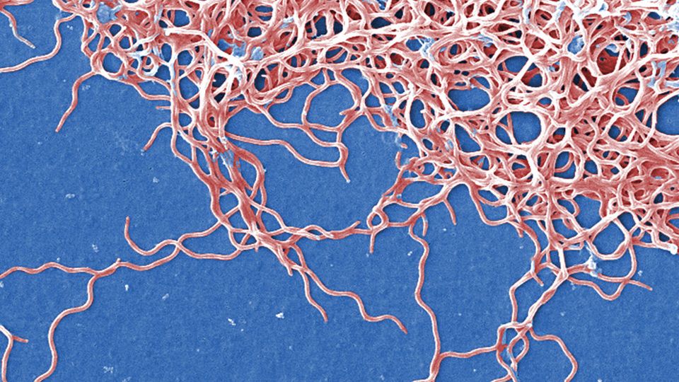 Digitally colorized scanning electron microscopic (SEM) image depicting a grouping of numerous, Gram-negative, anaerobic, Borrelia burgdorferi bacteria