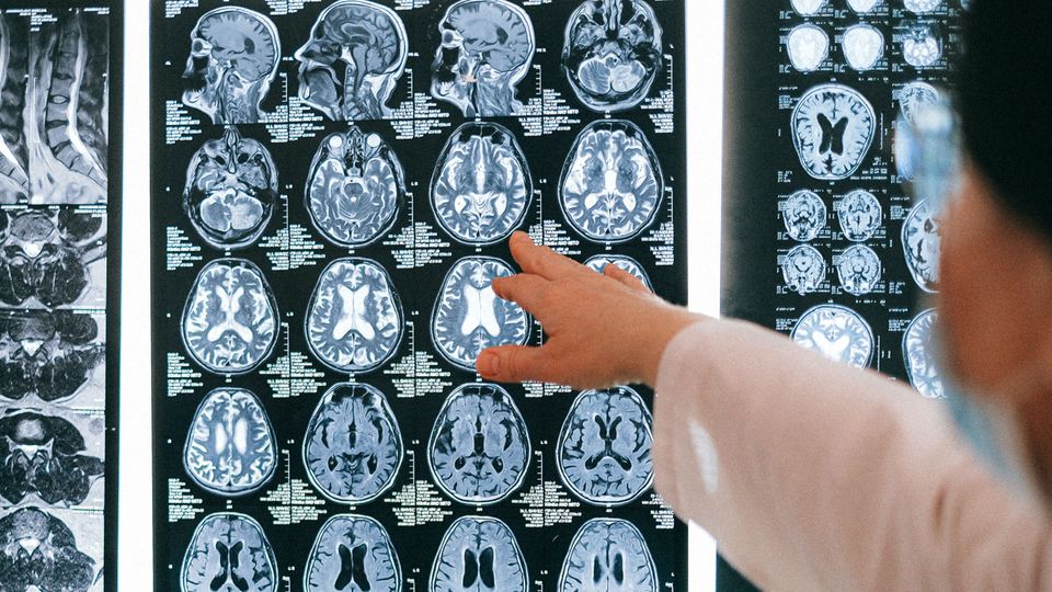 Brain scan images, with a clinician pointing at it.