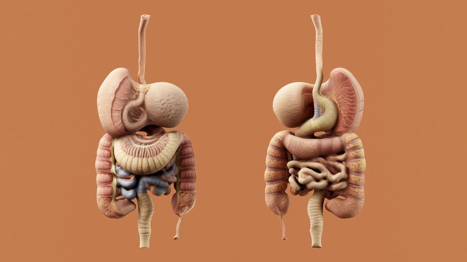 3D models of human digestive systems highlighting areas affected by Crohn’s disease.