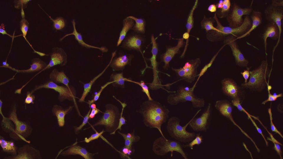 Cell Paint microglia cells.