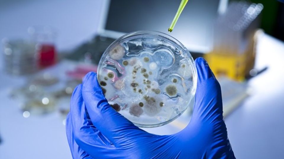 Bacterial colonies in a petri dish prepared for SoluLyse bacterial protein extraction.