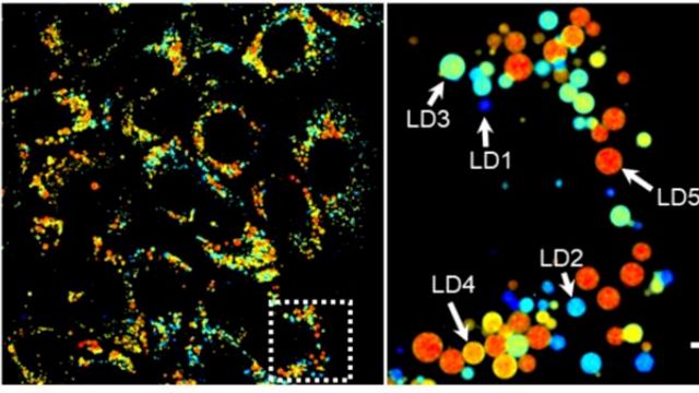 Color mapping shows metabolic activity of individual lipid droplets. Red represents longer fluorescence lifetimes (basal droplets), while blue indicates shorter lifetimes (degrading droplets). Right: Magnified view of the white dotted square, highlighting droplets in different metabolic states. 