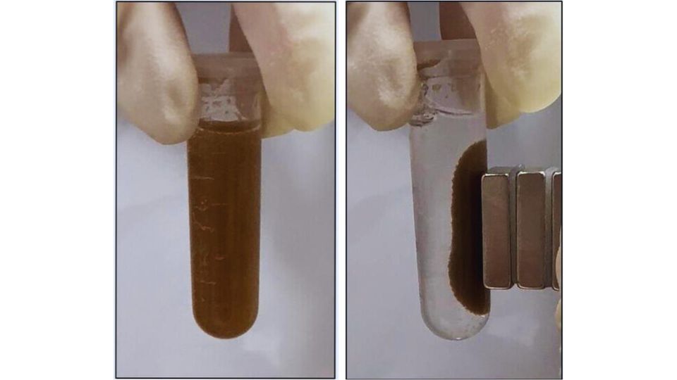 Image 3 for Engineered bacteria pills offer noninvasive gut disease diagnosis