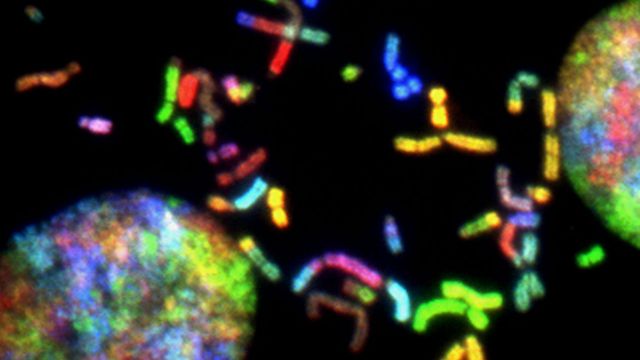 Fragmented cancer chromosomes from glioblastoma. 