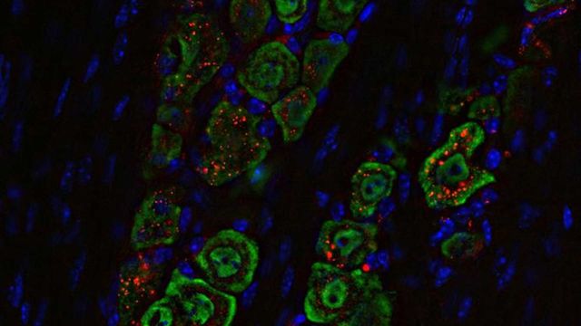 Microscopic image of red spherical nucleic acid nanoparticles traveling along a green nerve from nose to brain. 