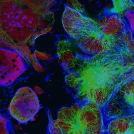 Graphic for ‘The Spatial Biology Revolution 2026’ online symposium with fluorescent cell imagery