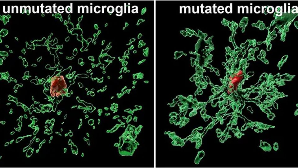 Two images of microglia, one without the protective mutation, which are sparse, and one with, which are densely packed.