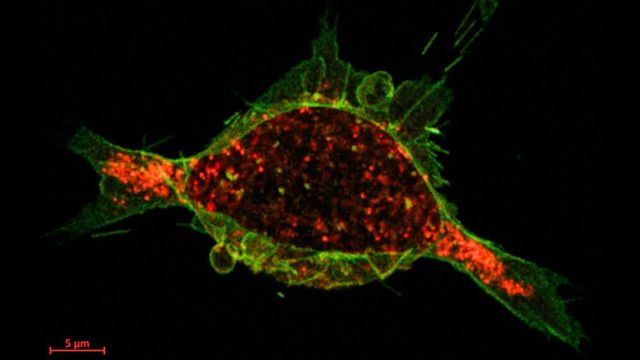 Fluorescent image of cell against black background, calcium-regulated drug (green) and tumor cell receptors (red) are displayed. 