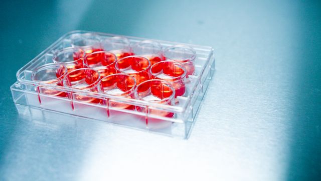 Cell cultures on a 12 well multiwell plate.  