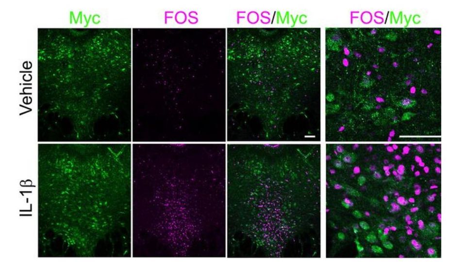 Fluorescent brain images showing IL-1β–driven activation of Myc and FOS neurons in the dorsal raphe circuit involved in social withdrawal.
