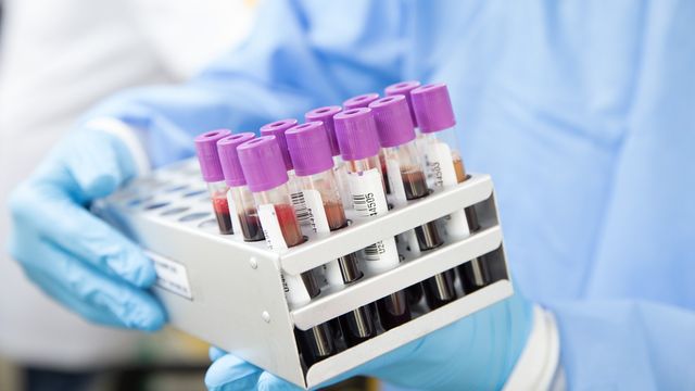 Blood sample vials in a lab rack used for profiling proteins tied to long-term mortality risk. 