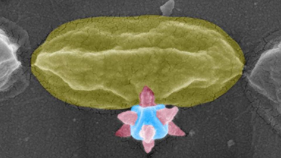 Colorized electron micrograph showing MOF nanospike structures mechanically puncturing bacteria to prevent biofilm formation.