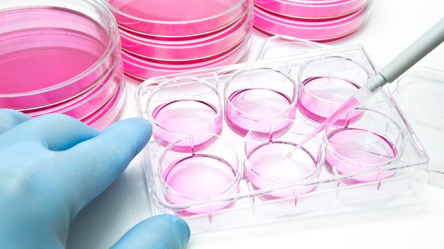 Methane-producing archaea from the species Methanosarcina acetivorans. The microbes are stained with a fluorescent dye that specifically binds to the membranes of archaea. 