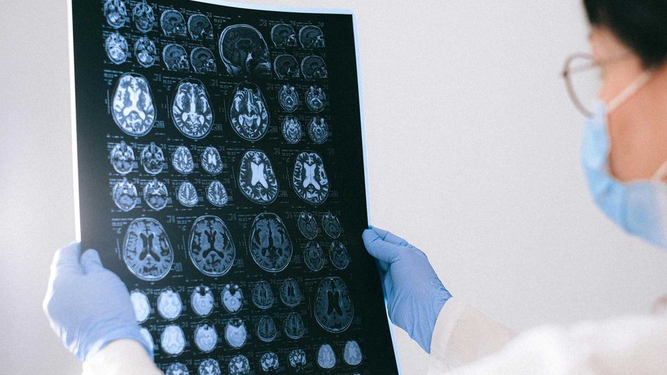 A doctor wearing blue nitrile gloves, holding a brain scan. 