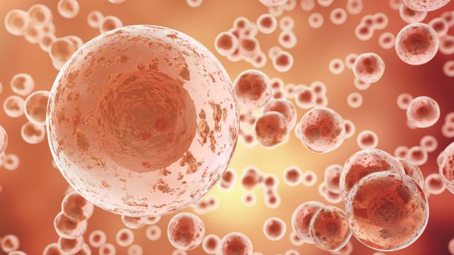 3D illustration of cancer cells multiplying, representing the spread of cancer in the body. 