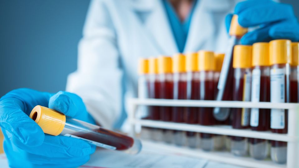 A researcher holds a blood-filled test tube, with a rack filled next to them.