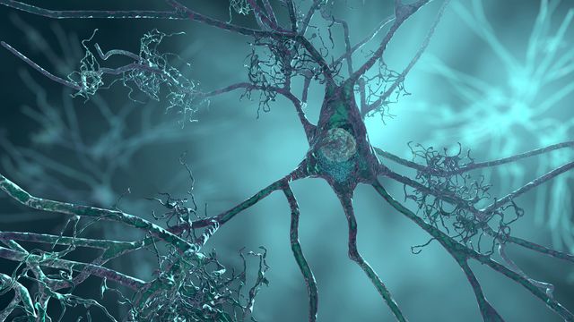 Detailed 3D rendering of a damaged neuron highlighting structural decay linked to neurodegeneration. 