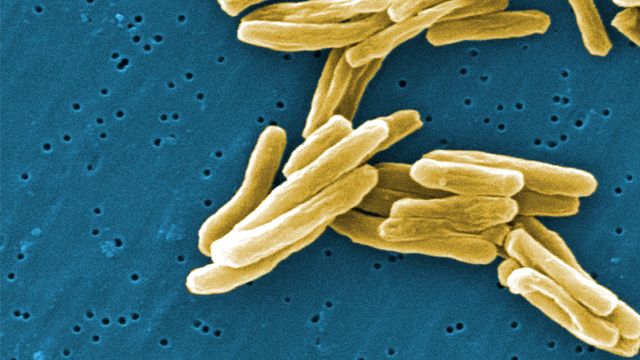 Gram-positive, Mycobacterium tuberculosis bacteria. 