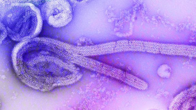 Digitally-colorized electron microscopic image of an isolate of Ebola virus 